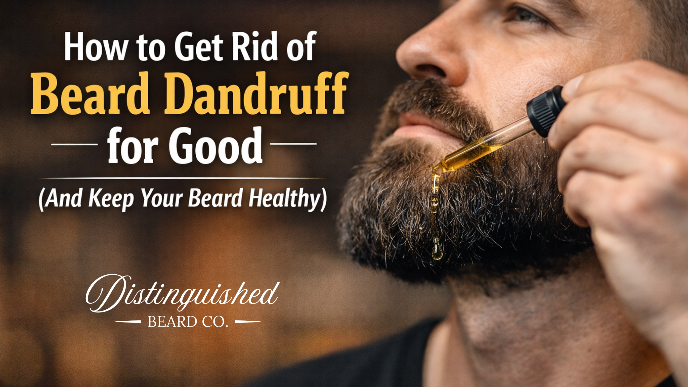How to Get Rid of Beard Dandruff for Good (And Keep Your Beard Healthy)
