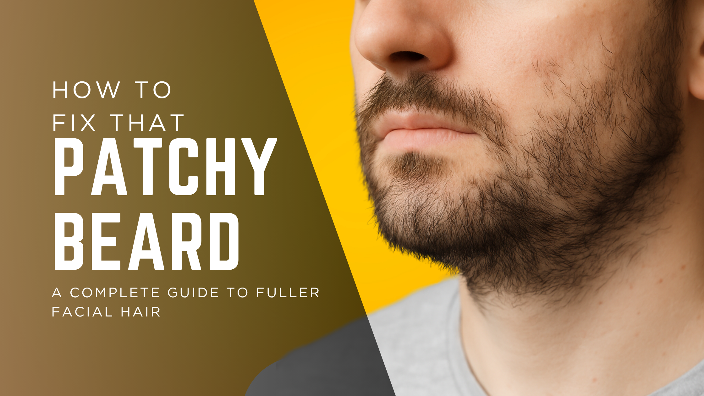 How to Fix Patchy Beard Growth: A Complete Guide to Fuller Facial Hair ...